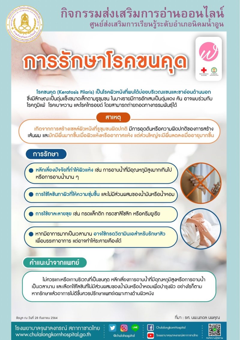 การรักษาขนคุด