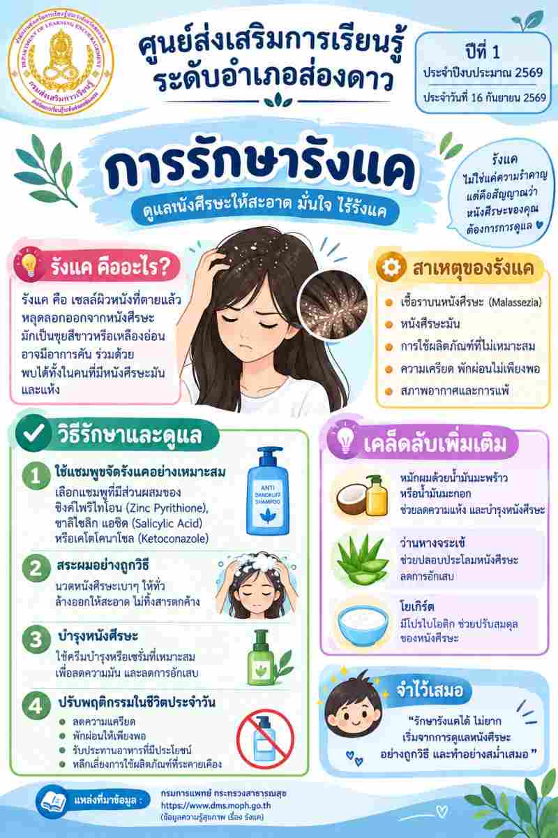  การรักษารังแค