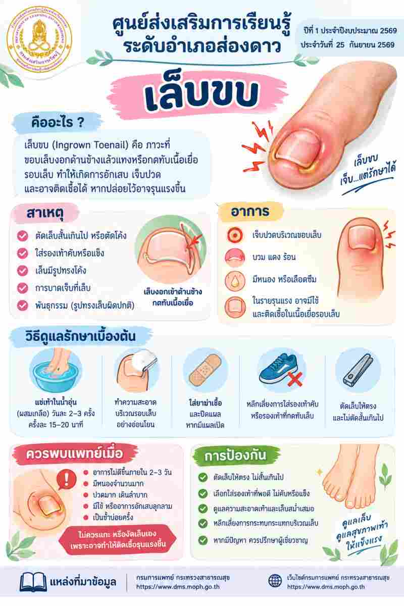 เล็บขบ